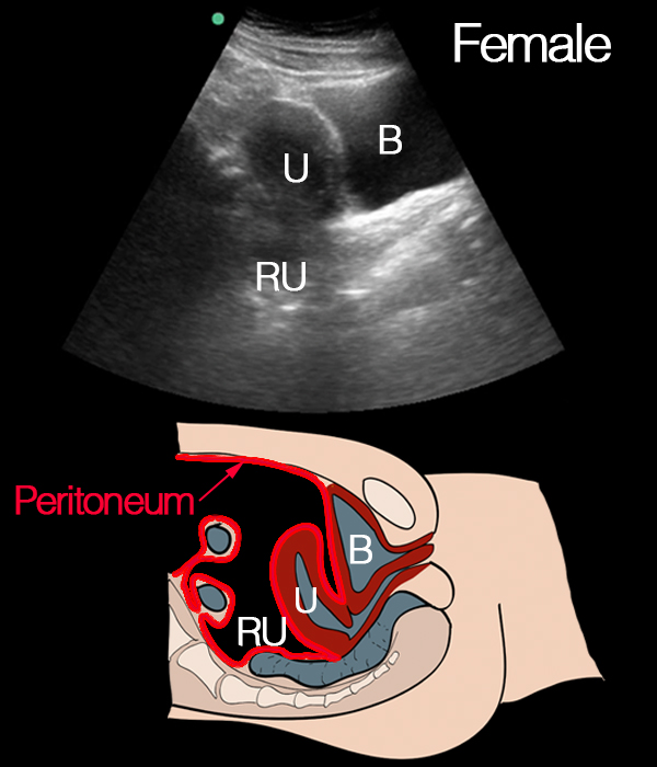 EEU case image missing